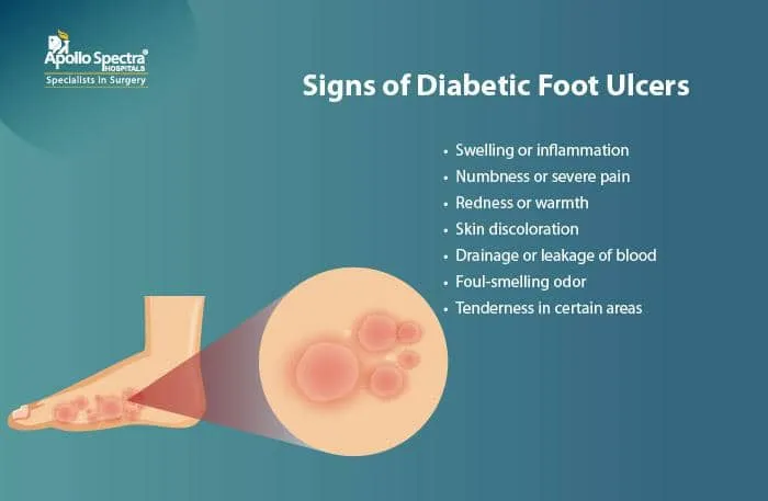 Understanding Diabetic Foot Ulcers - Treatment and Preventive Care